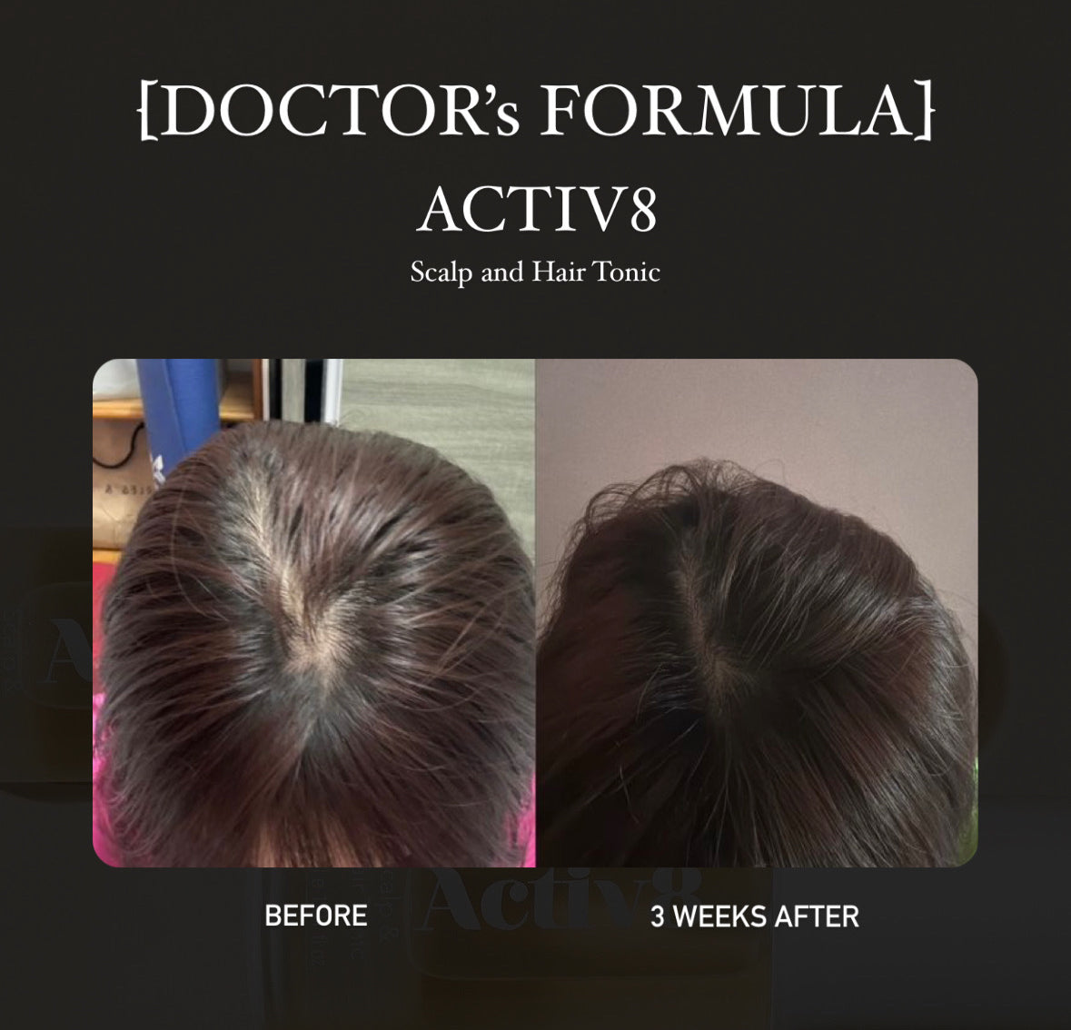 [Doctor's formulas] ACTIV8 Scalp & Hair Tonic 30ml