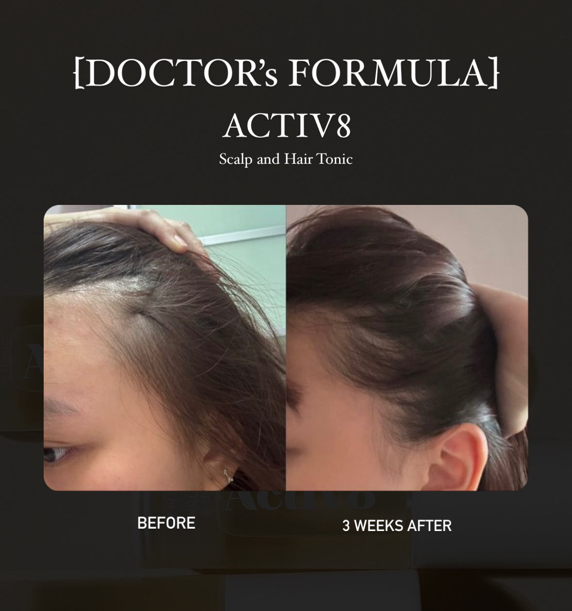 [Doctor's formulas] ACTIV8 Scalp & Hair Tonic 30ml